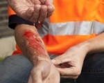 accident claim at work