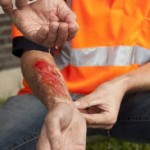 accident claim at work