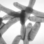 legionnaires disease