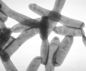 legionnaires disease