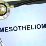 mesothelioma