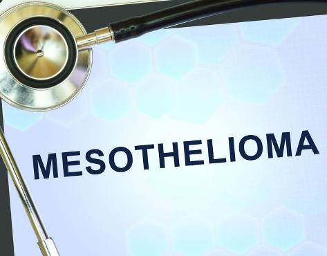 Who is Eligible to File a Mesothelioma Wrongful Death Lawsuit?